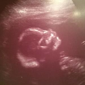 Meet your Posher, Jesse